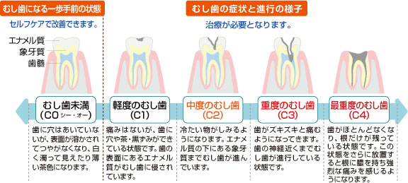 歯の構造について